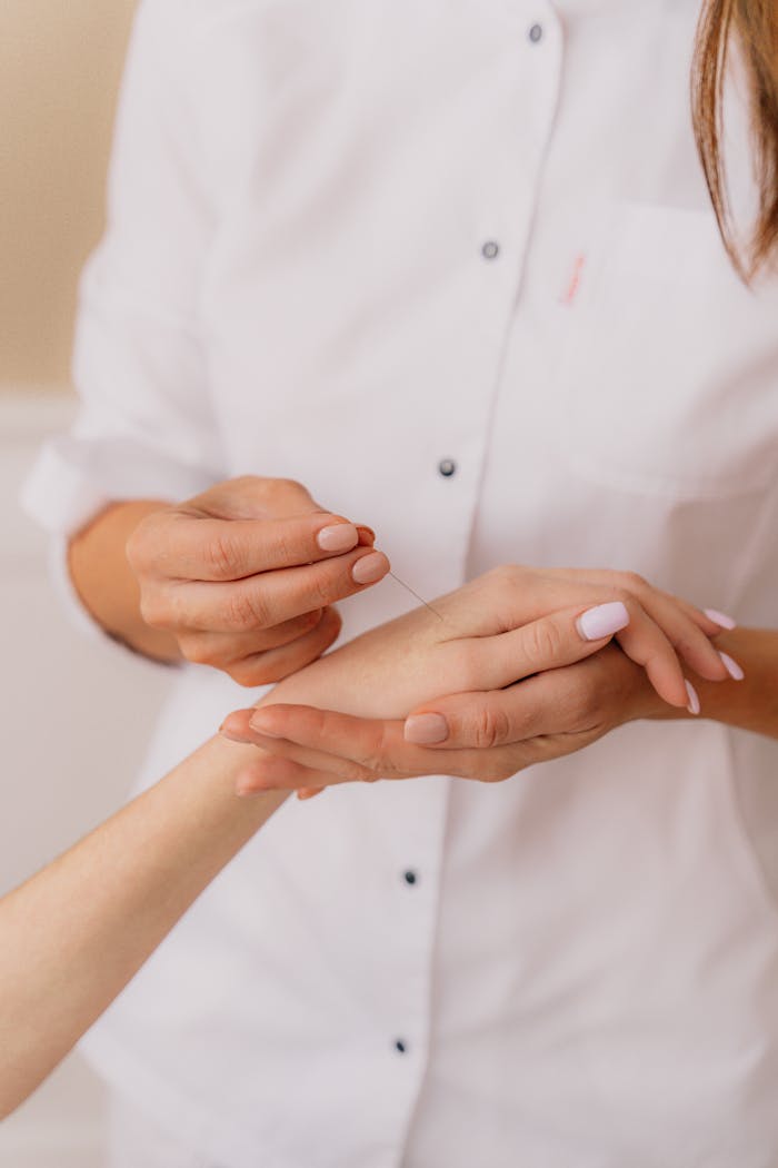 Acupuncturist carefully inserting needles into a patients hand during therapy session.